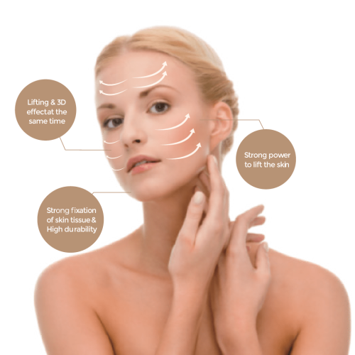 Volume thread lifting by filling in the skin